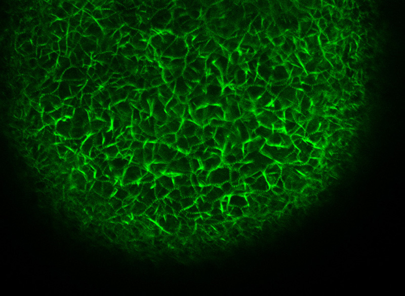 Colorazione dei filament di actina in un ovocita di stella di mare microiniettato con falloidina coniugata con Alexa 568