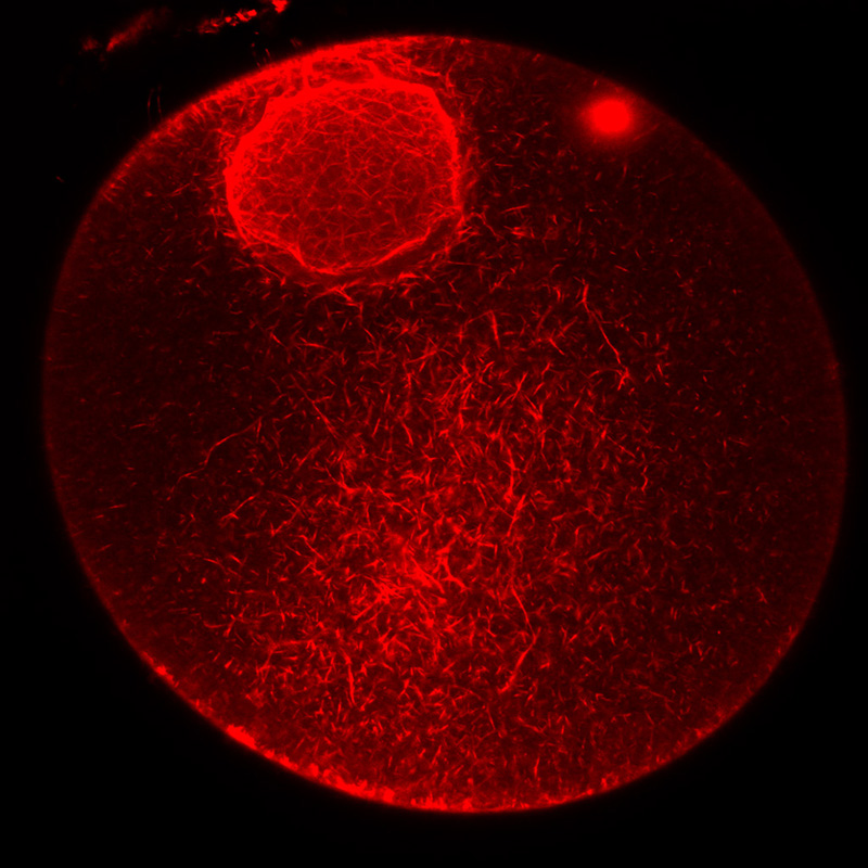 Visualizzazione di filamenti di actina nel nucleo e cytoplasma di un ovocita immaturo di stella di mare